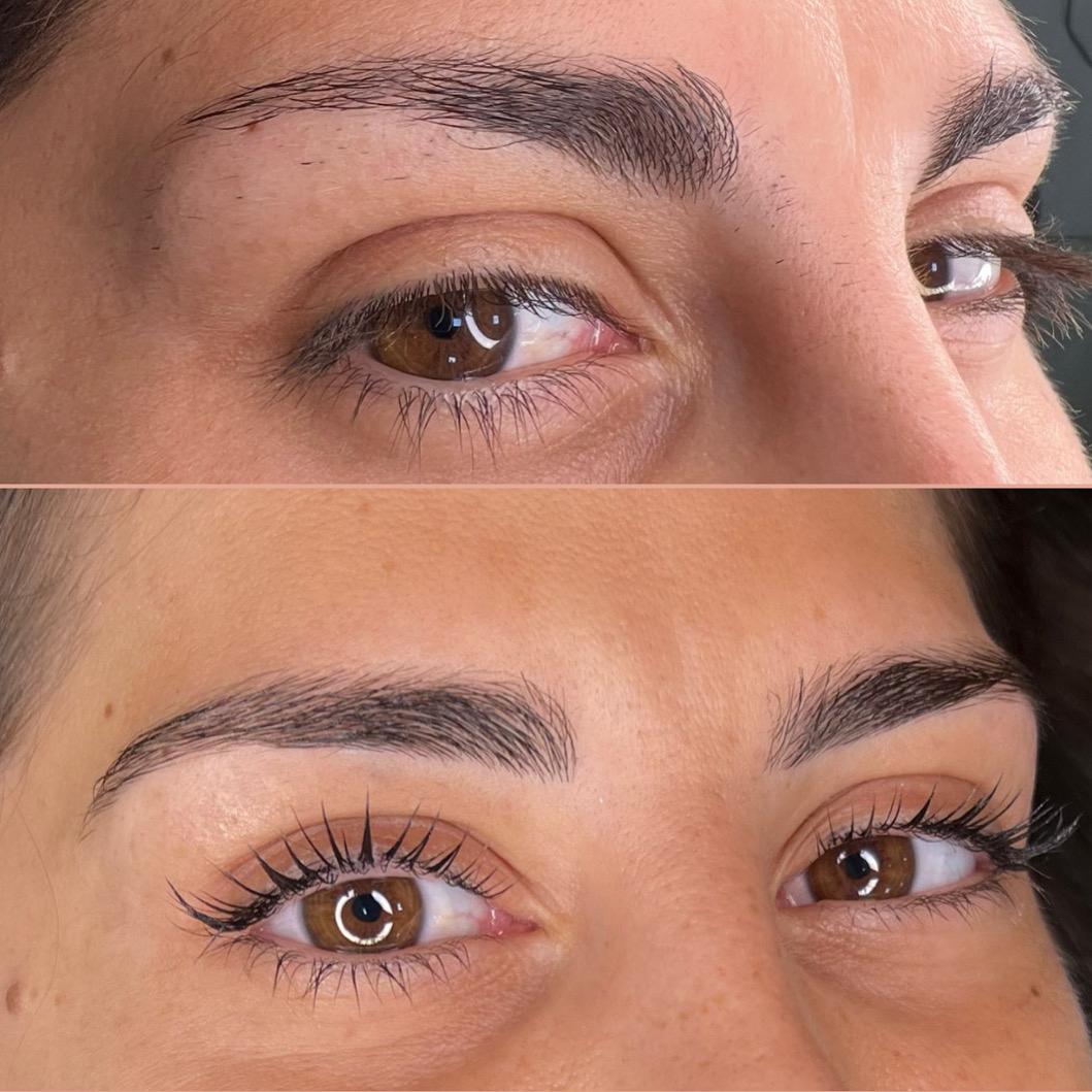 Antes e Depois