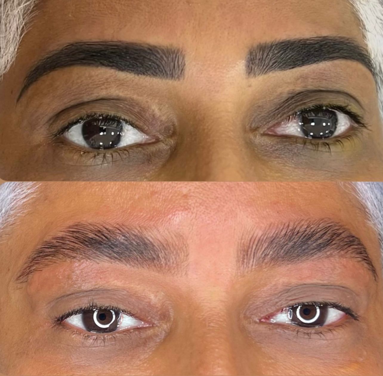 Antes e Depois