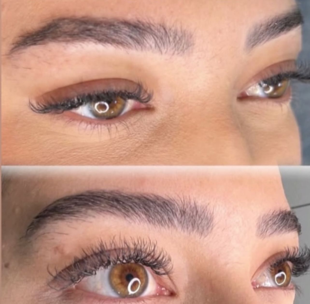 Antes e Depois